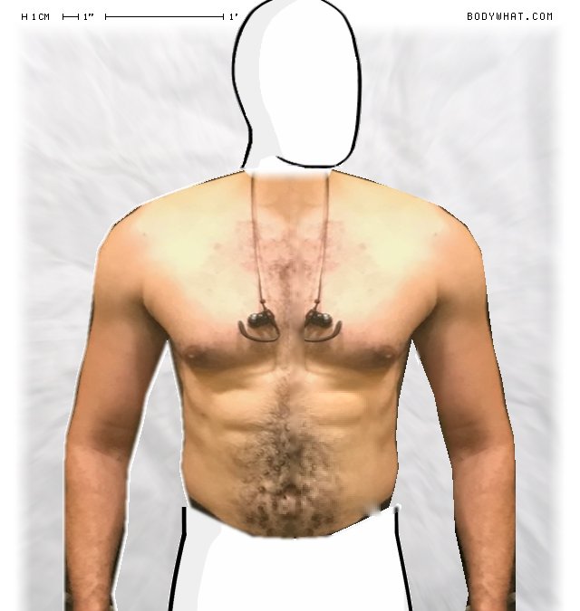 Picture 1