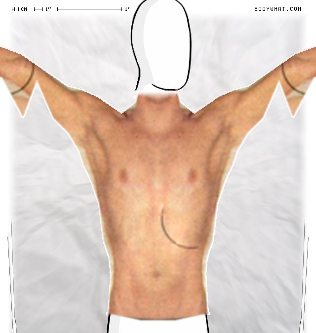Picture 1
