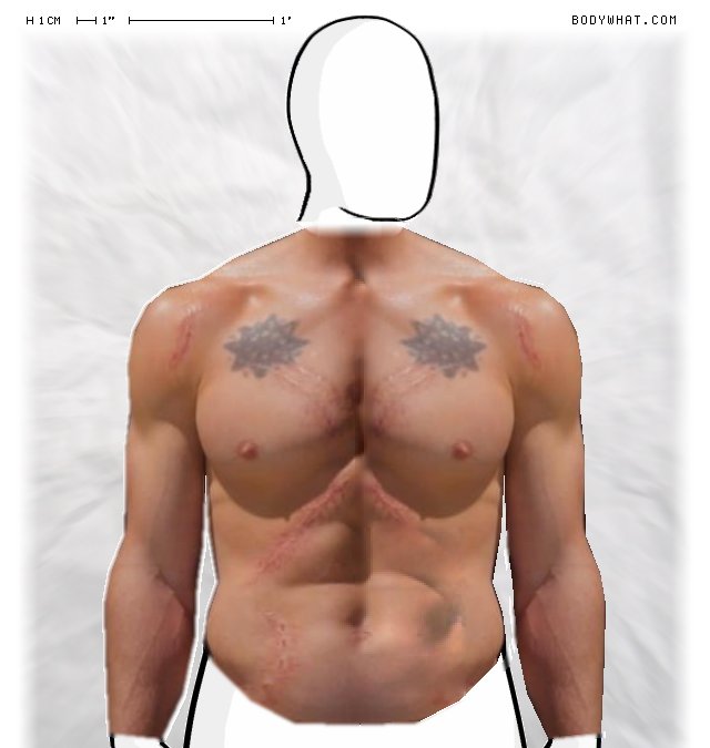 Picture 1