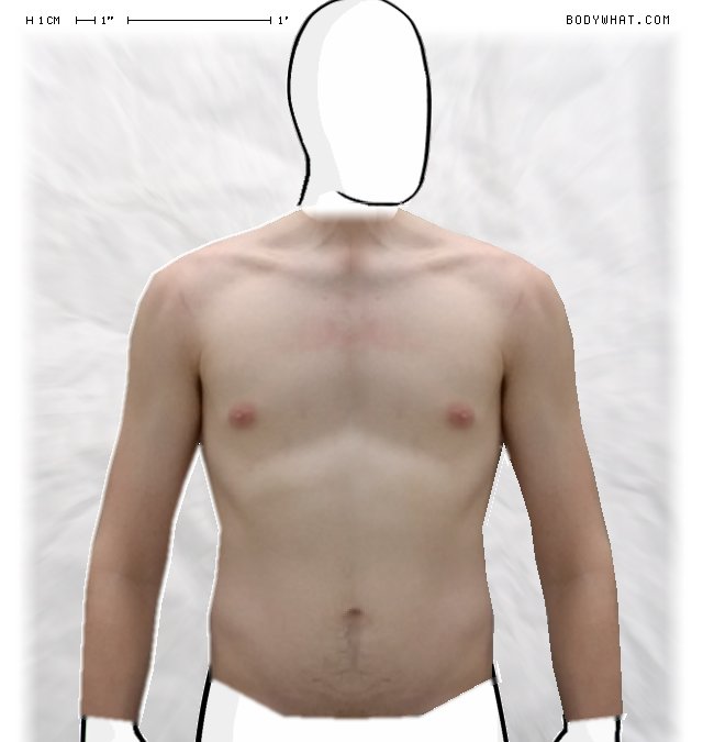 Picture 1