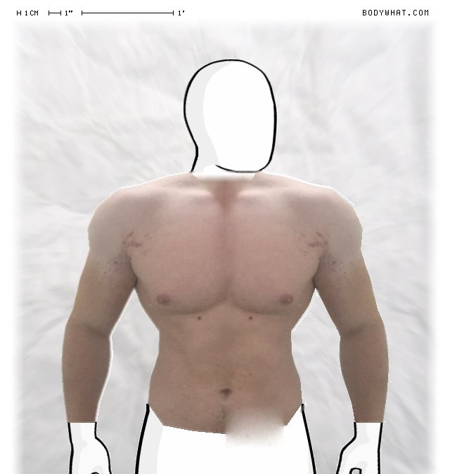 Picture 1