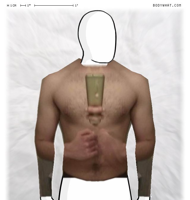 Picture 1