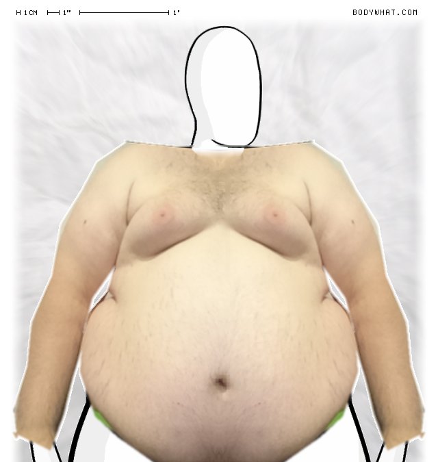 Picture 1