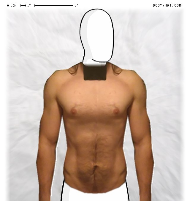 Picture 1