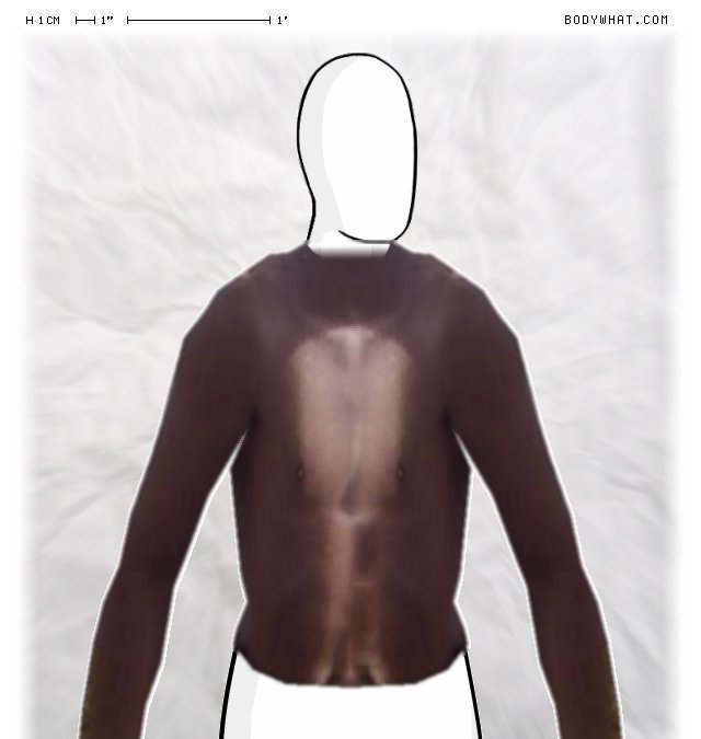 Picture 1