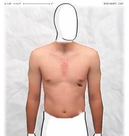 Torso