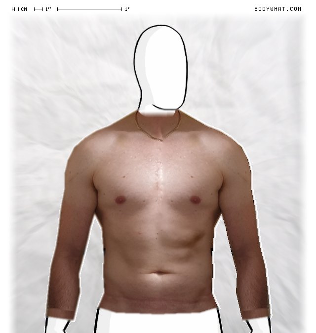 Picture 1